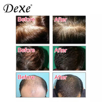 Dexe Anti-Hair Loss Shampoo 7oz Stop Hair Loss & Regrowth For Textured Hair